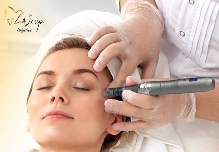 derma pen in al mamzar la joya clinic dubai